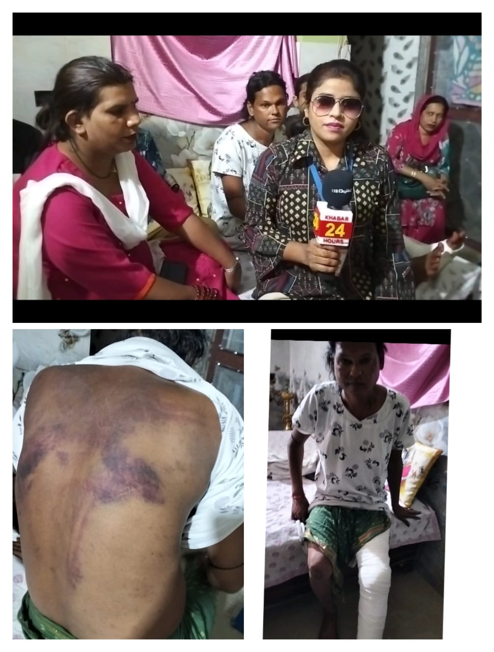 किन्नर मैडम रजनी रावत ने गुंडों से अपने ही समाज के किन्नर पर कराया हमला! शून्य कार्यवाही